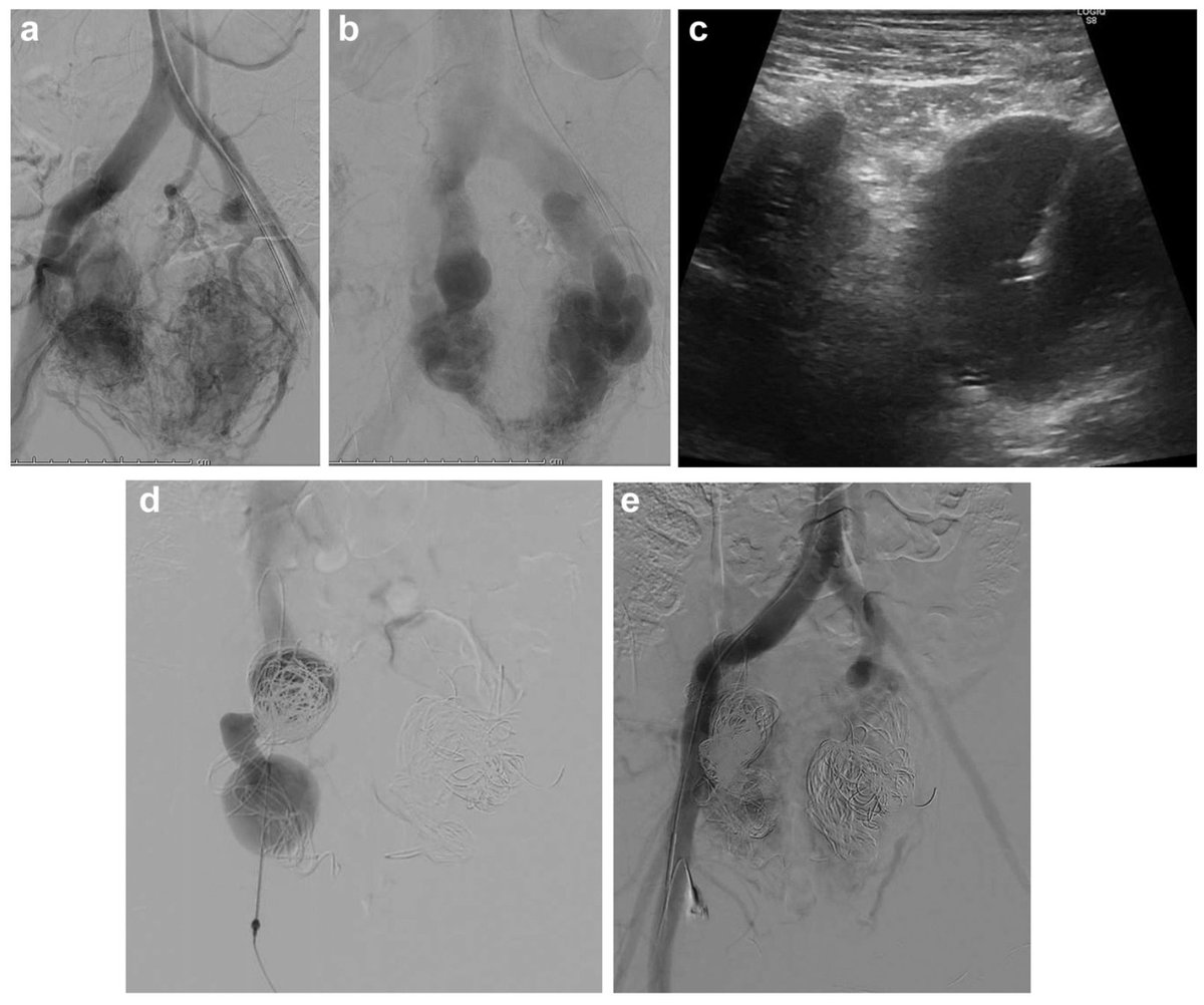JVS - Venous and Lymphatic Disorders tweet media