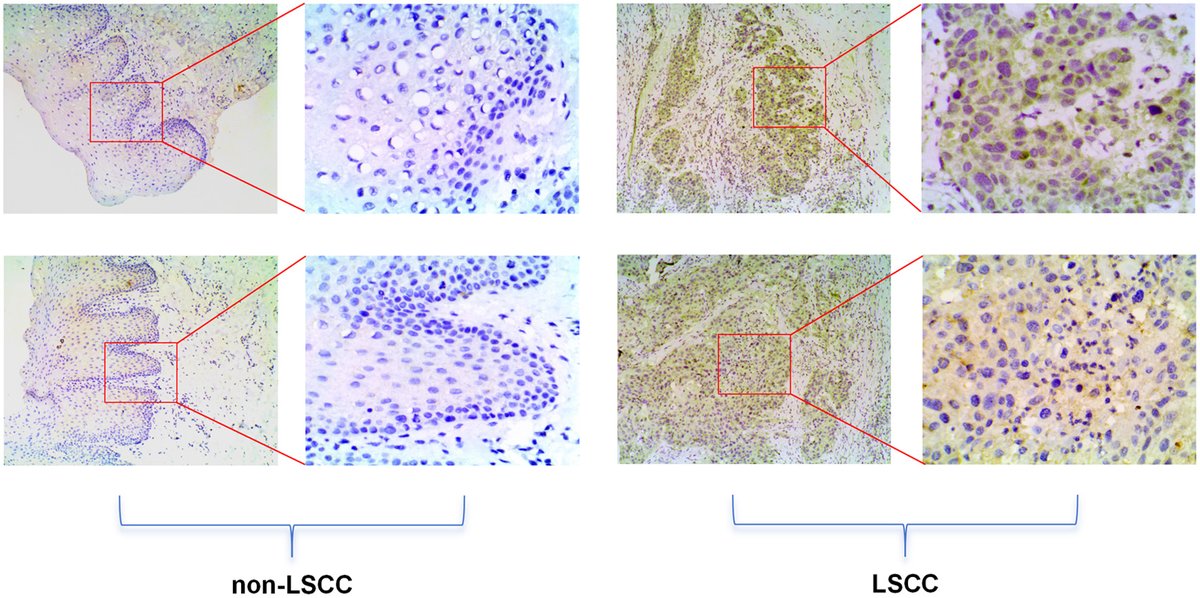 World Journal of Oncology tweet media