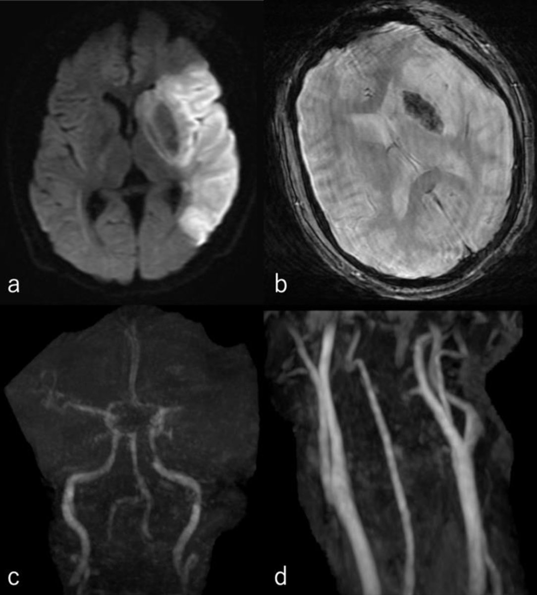 Journal of Neurology Research tweet media