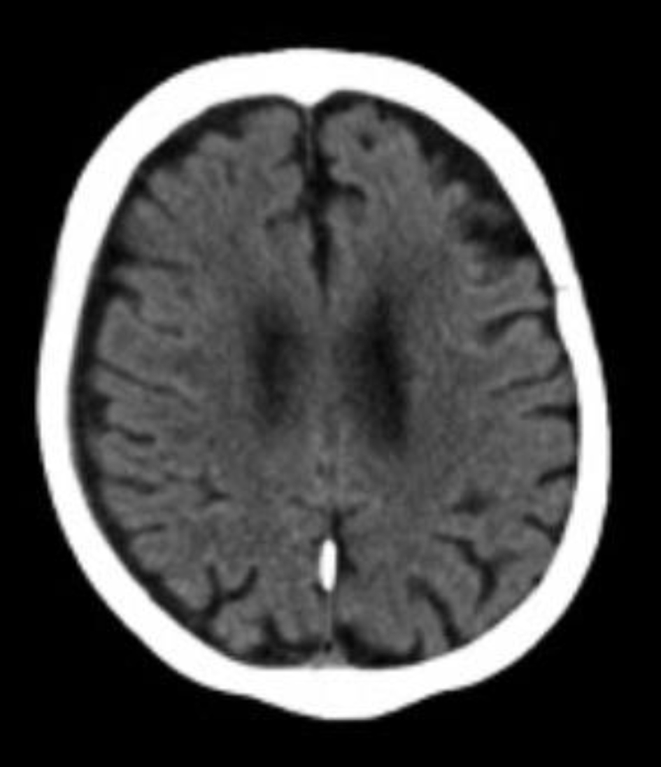 Journal of Neurology Research tweet media