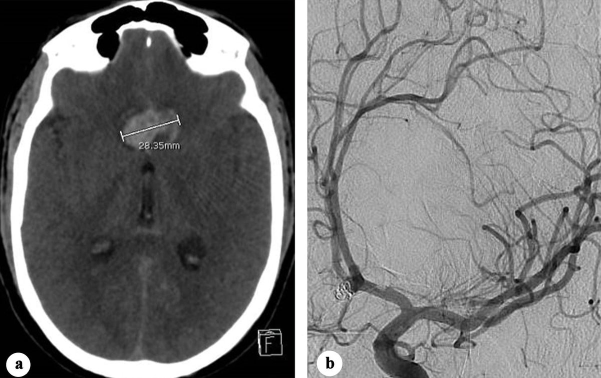 Journal of Neurology Research tweet media