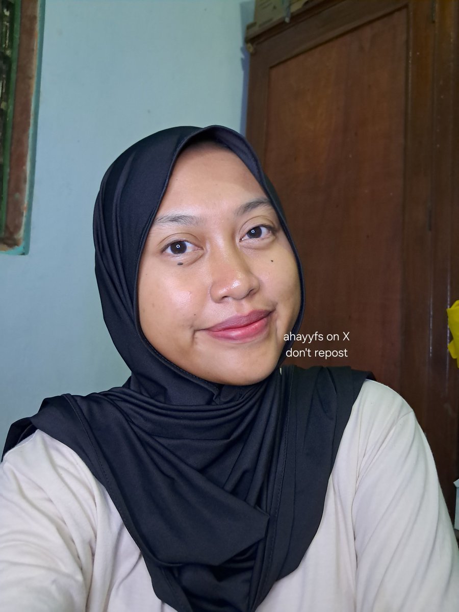 ahayyfs's tweet image. Alhamdulillah udah setahun berjuang lawan jerawat

Yang dimulai januari muncul jerawat kecil yang aku kira karna mau menstruasi aja eh tapi makin hari kok makin banyak

Dan ini kondisi wajahku sekarang✨️

Februari 2025                 Desember 2025