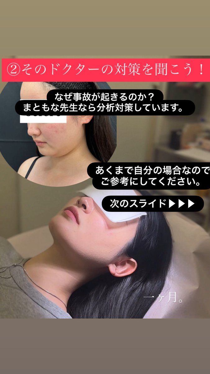 dr_yokose's tweet photo. #ルラ美容クリニック 
#ルラ美容クリニック郡山院 

私見が大きいので、あくまでご参考に。
続く https://t.co/y1z6zBiq4u