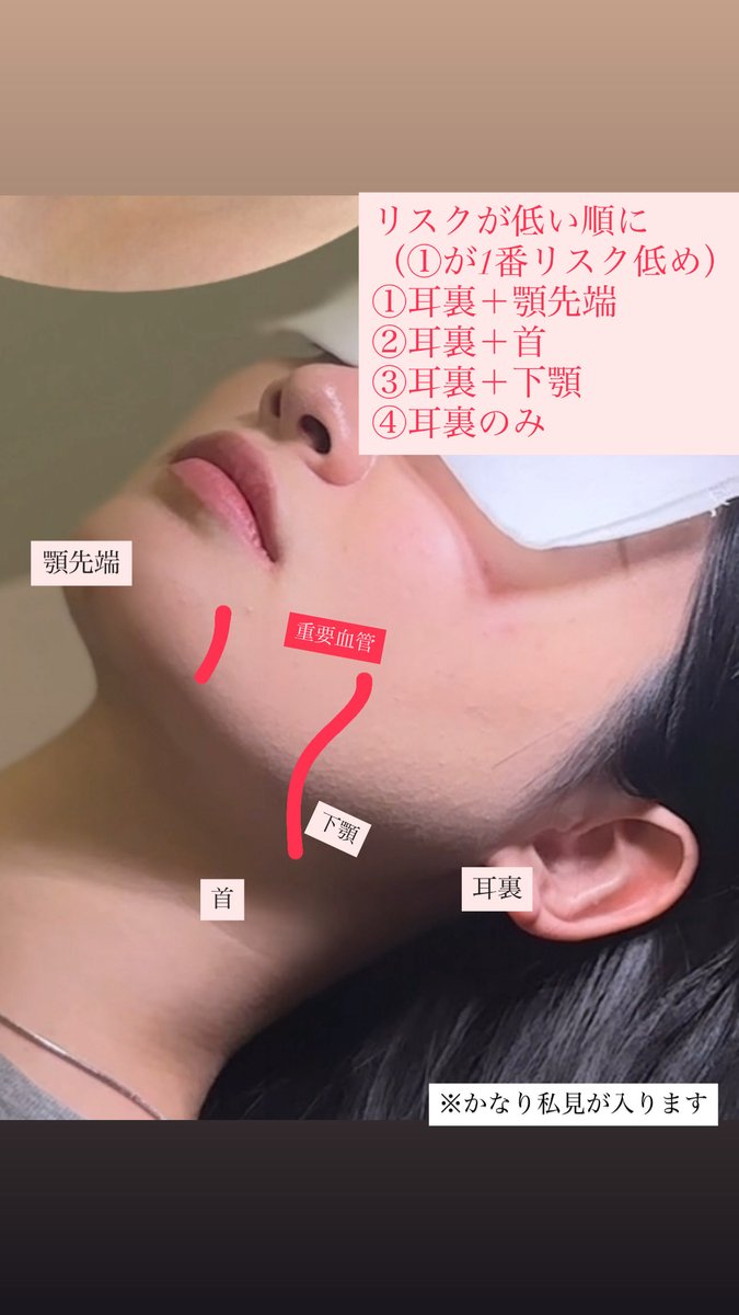 dr_yokose's tweet photo. #ルラ美容クリニック 
#ルラ美容クリニック郡山院 

続く https://t.co/tifdXMN2tR