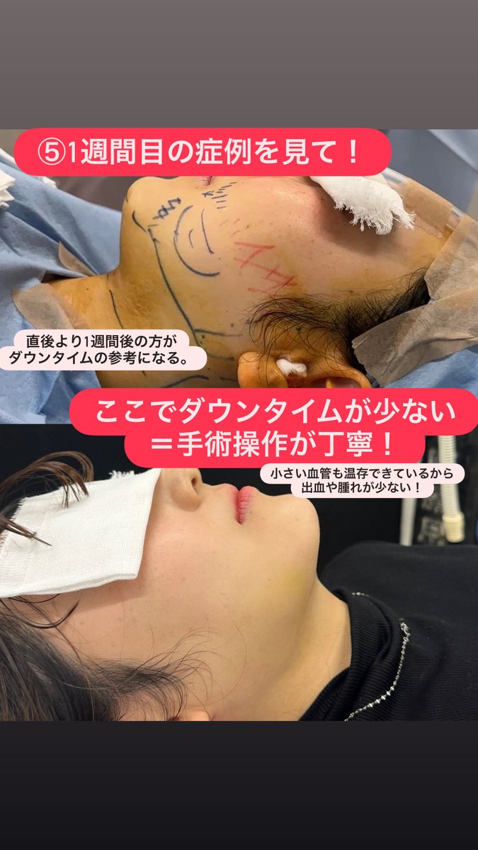 dr_yokose's tweet photo. #ルラ美容クリニック 
#ルラ美容クリニック郡山院 

参考になれば嬉しいです。 https://t.co/H3km1DY12c
