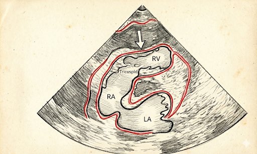 Tudor Toma tweet media