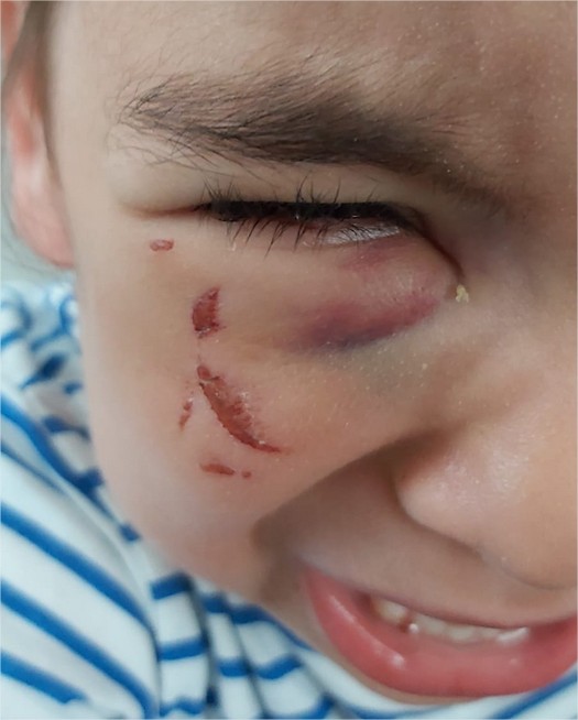 JCQDSE's tweet image. Ils sont quelques centaines à Paris, errant comme l'homme qui a poignardé trois femmes dans le métro. Abîmés, détruits. 

"Accueillis" en France par la bien-pensance de culs-bénis et le crack. Régulièrement ils passent à l'acte. Les victimes elles passent par pertes et profits.