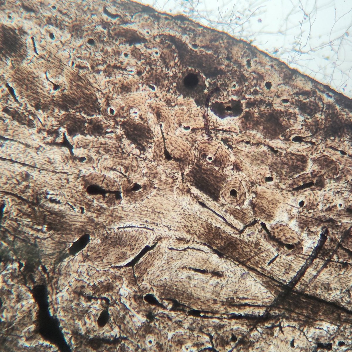 justran29's tweet image. Muskuloskeletal in a nutshell: 💪🦴🩻