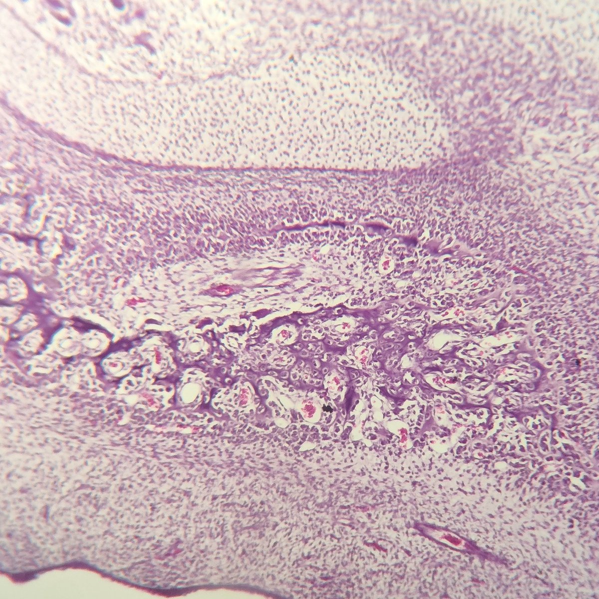 justran29's tweet image. Muskuloskeletal in a nutshell: 💪🦴🩻