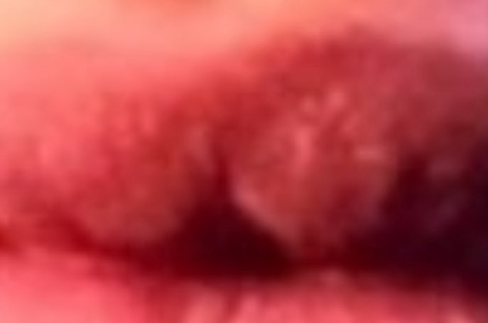 andreipm's tweet image. Formou um granuloma na boca