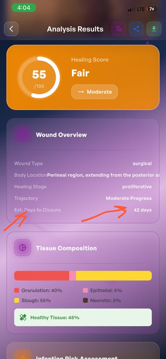MuokaCharles2's tweet photo. My wife surgical procedure wound healing determined by our app NOSTRAHEALTH AI.

We’re now tracking the healing from home, no more hospital visits 

Recommendations, treatments and drugs where all included 

We’re coming 🚀🚀 https://t.co/GgEnGl3Tre