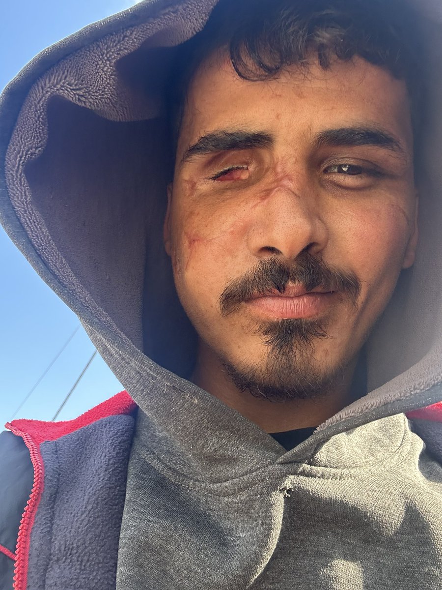 fares__2001's tweet image. If u believe me,  PLEASE leave a dot . it's just a dot ✋

gofund.me/2618b3856