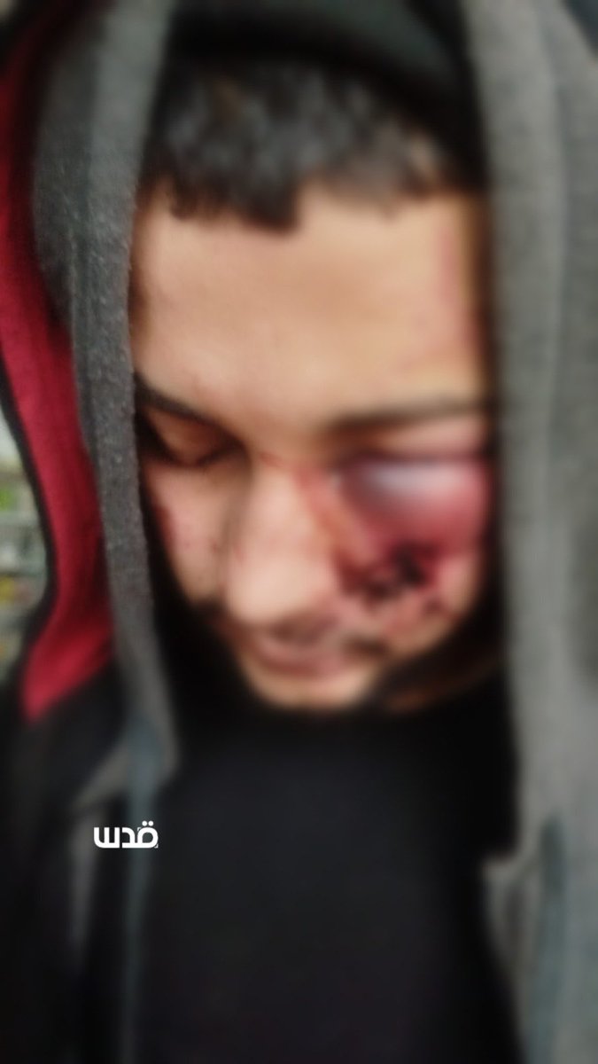 QudsNen's tweet image. Israeli occupation forces release a group of Palestinians from Tulkarm at the entrance of the town of Deir Istiya, near Salfit, after severely assaulting them.