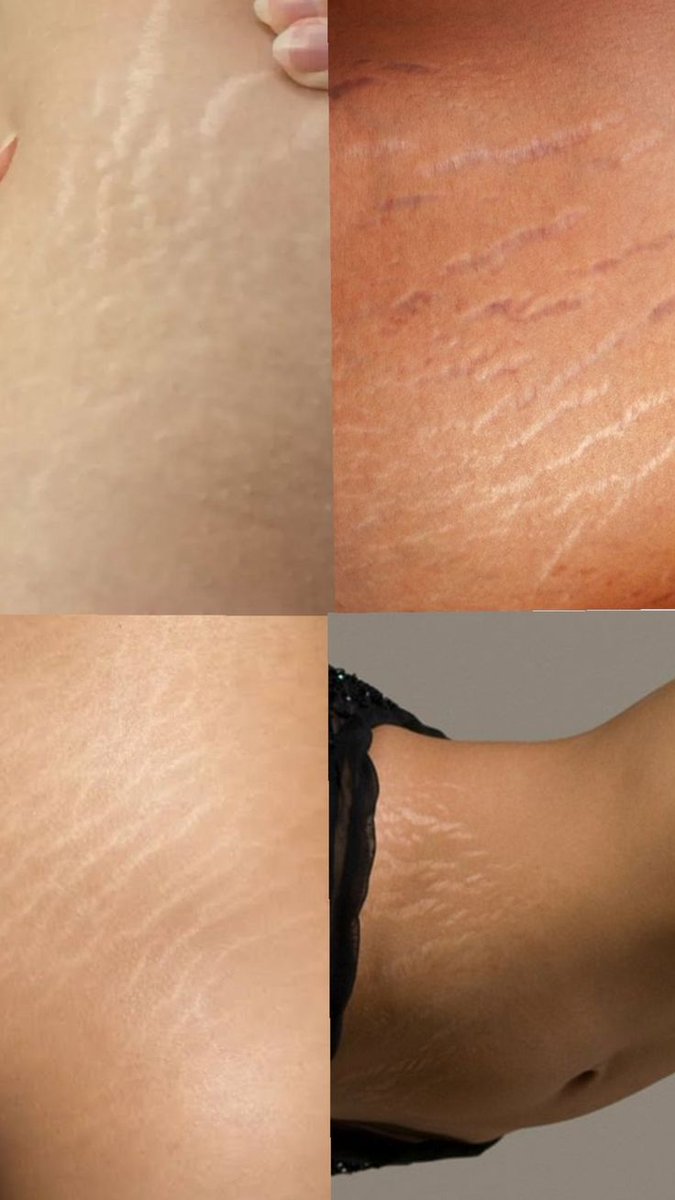 yaren✨️ tweet media