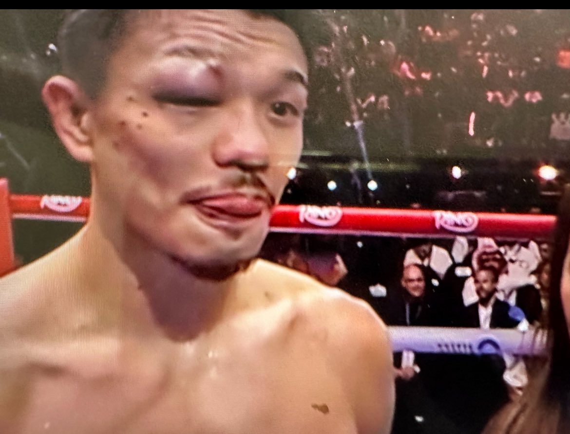 I said it on the podcast and I gave it out in a typed up report for all members at the ropes over 8.5 rounds, fight goes the distance and that the underdog would be very live in a firestorm fight  unfortunately the judges had other plans. 118-110 incompetence or corruption ?