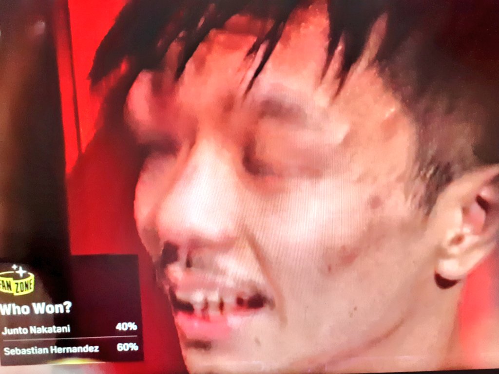 Intenxsifys's tweet image. I dont wanna see Nakatani vs Inoue anymore. I wanna see Hernandez vs Nakatani 2 (this fight deserves a rematch). Get Nakatani out of the Pound for Pound list ASAP. No longer Top 10. We wanna see a rematch