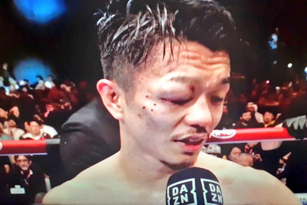 Intenxsifys's tweet image. I dont wanna see Nakatani vs Inoue anymore. I wanna see Hernandez vs Nakatani 2 (this fight deserves a rematch). Get Nakatani out of the Pound for Pound list ASAP. No longer Top 10. We wanna see a rematch