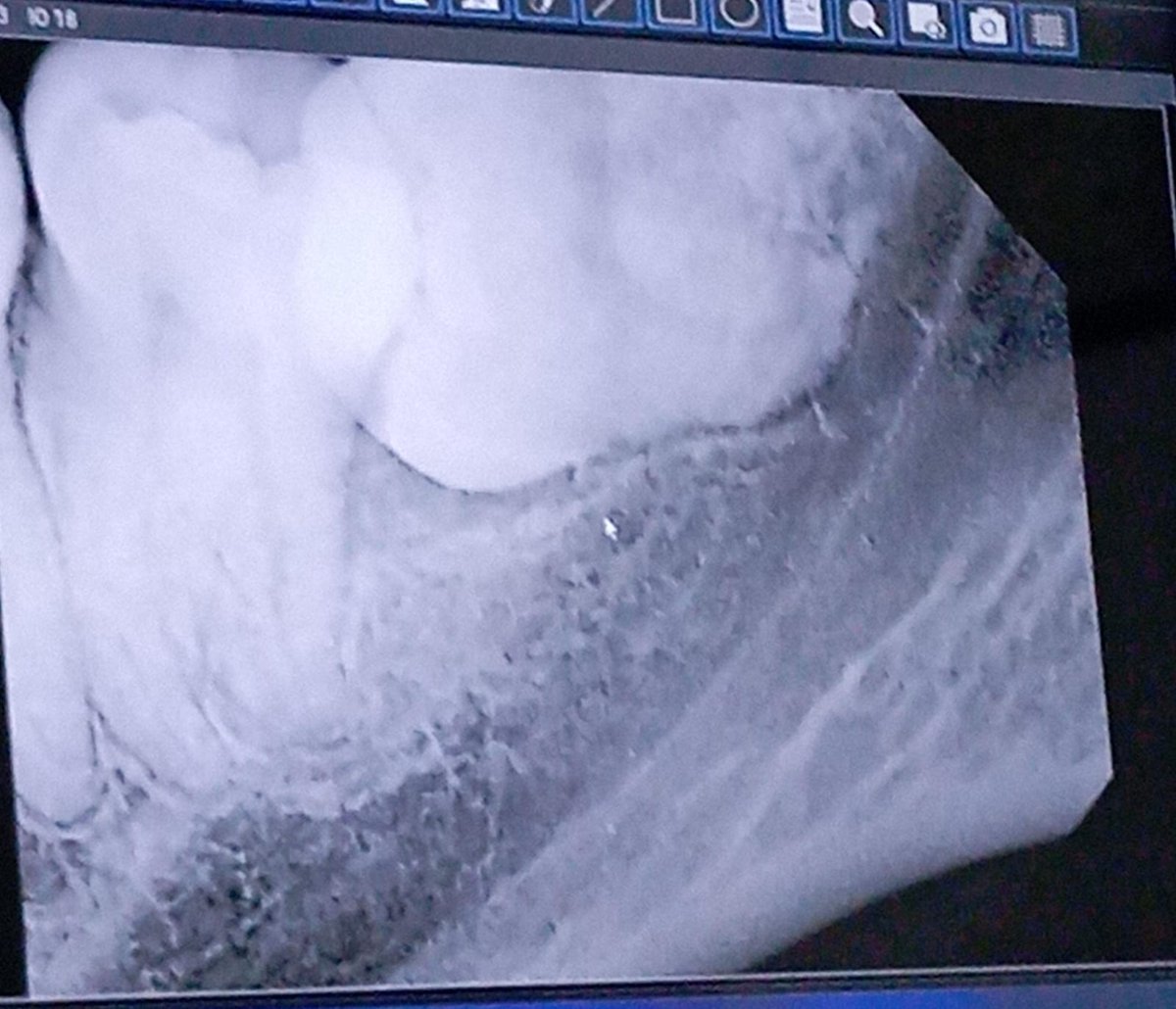 gente les tengo malas noticias, me sacaron la muela del juicio y no puedo hablar ni hacer nada por unos días y eso significa que no podre hacer streaming y editar el video que tenía planeado, se pospone todo para el año que viene, solo me queda desearles un feliz año a todos TKM