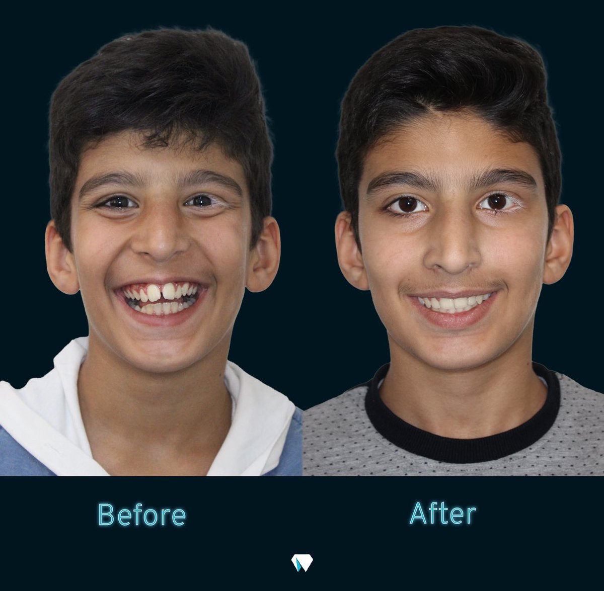 متخصص ارتودنسی 🦷 tweet media