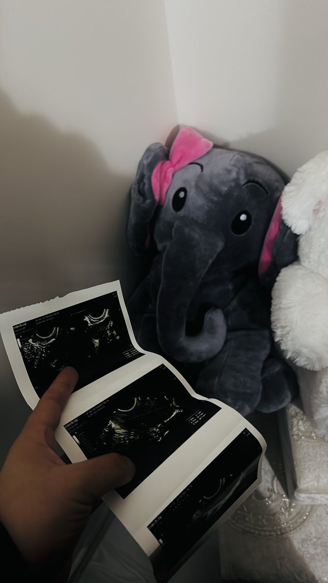 Sağlıkla gelin bebeklerim 🥹🙏🏻