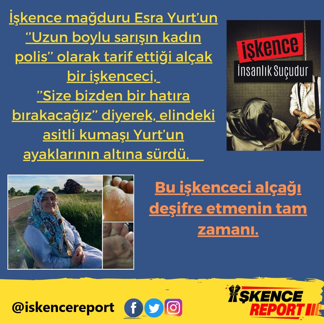 IskenceReport's tweet photo. İşkence mağduru Esra Yurt’un ‘’Uzun boylu sarışın kadın polis’’ olarak tarif ettiği alçak bir işkenceci,"Size bizden bir hatıra bırakacağız" diyerek, elindeki asitli kumaşı Yurt’un ayaklarının altına sürdü.

HukukGelsin İşkenceBitsin https://t.co/Mgukso1Lk7