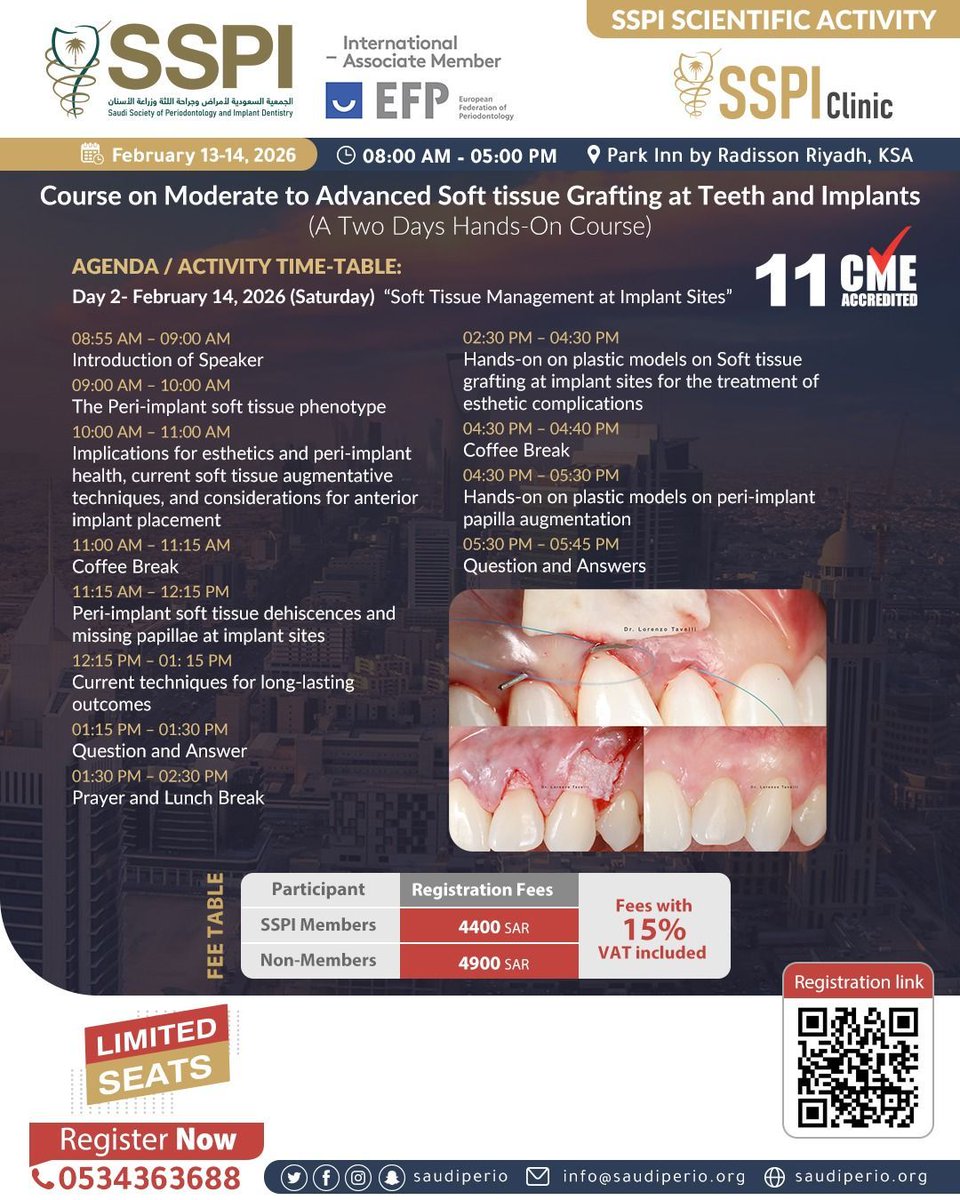 Saudi Society of Periodontology &amp; Implant Dentistry
Upcoming Scientific Activities #SSPIClinic

"Course on Moderate to Advanced Soft tissue Grafting at Teeth and Implants (Lecture and Hands-On) "

🗓️13 Feb, 2026 
⏰ 08:00 AM 🇸🇦
📍Park Inn by Radisson Riyadh, Riyadh, KSA

Register