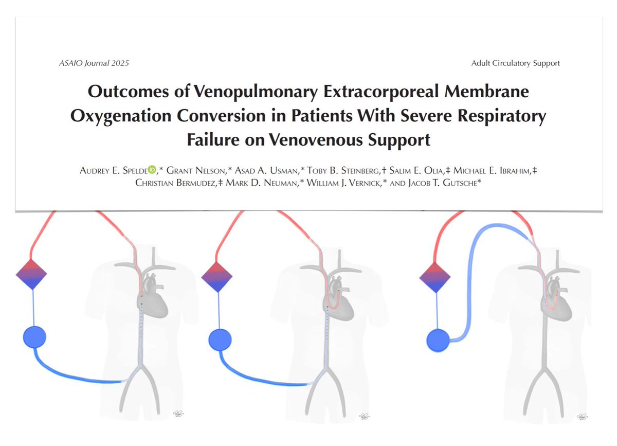 FOAMecmo's tweet photo. Conversion from VV of VP #ECMO in adults with severe respiratory failure complicated by refractory RV dysfunction associated with improved oxygenation, hemodynamic stability, end-organ function. Specifically, it:
🫘 facilitated #AKI resolution if pre-conversion AKI + was associated with increased liberation from CRRT 
🩸 reduced pressor & ECMO flows requirements
💨 resulted in reduced SGF/FdO2 & FiO2
💉 facilitated sedation weaning, previously not tolerated due to desaturation events  
@asaiojournal   
🔗 https://t.co/Od4kyImux3