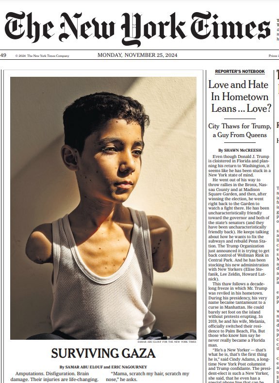 No. This child is not “surviving Gaza”.

He’s surviving a US-Israeli holocaust that left him paraplegic.

Mahmoud, only 9 years old