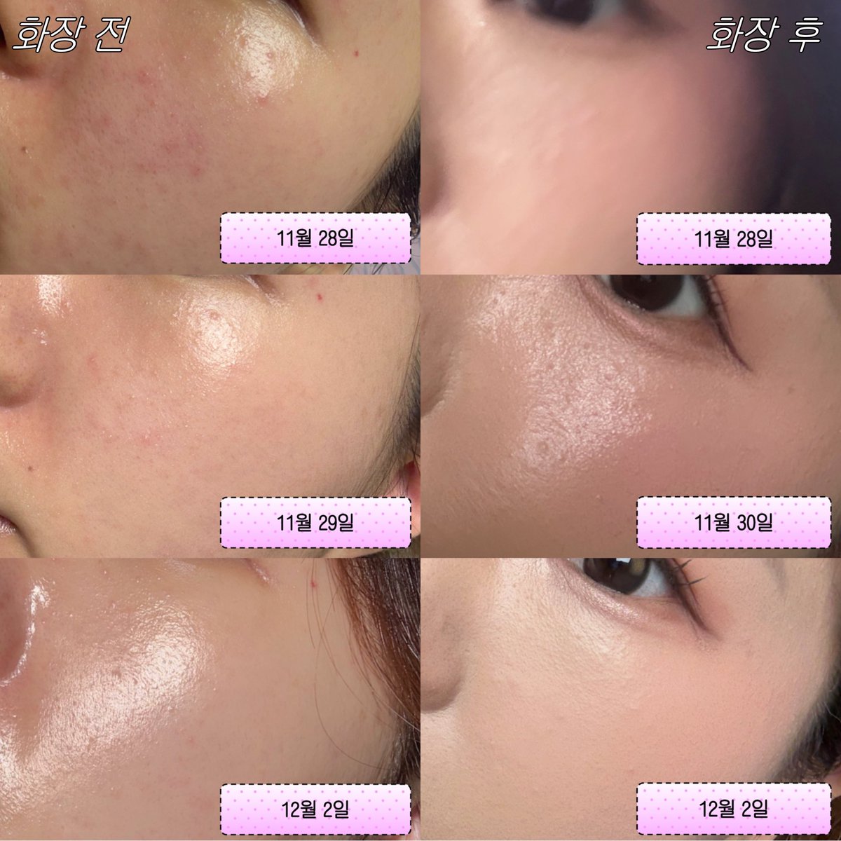 nyangnyang218_'s tweet image. #광고 @innisfree_kr 

#RT 3분께 이니스프리 레티놀 시카 흔적 앰플 뚱시바 기획세트를 드립니다🐶 (1/2일 당발)

이니스프리 레티놀 맹신자 냥뉴 인사 드리옵니다. 광고지만 찐으로..  올해 내 돈 주고도 사서 꾸준히 쓰는 유일한 레티놀 공병템🥹❤️‍🔥

제 B&amp;amp;A 사진.. 진짜 전부 맹세하고 갑자기…