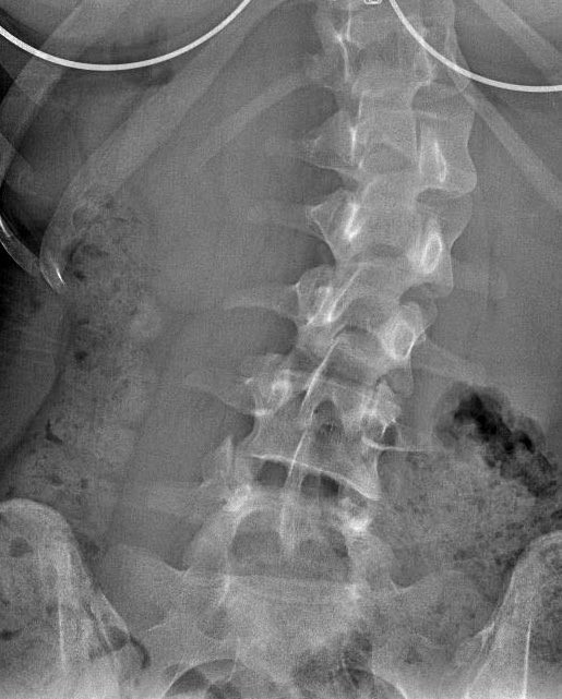 ぷんく tweet media