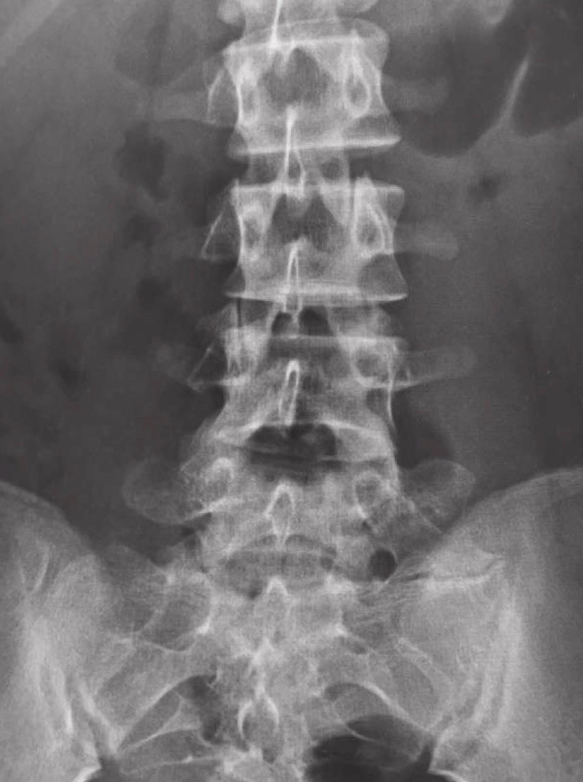 ぷんく tweet media