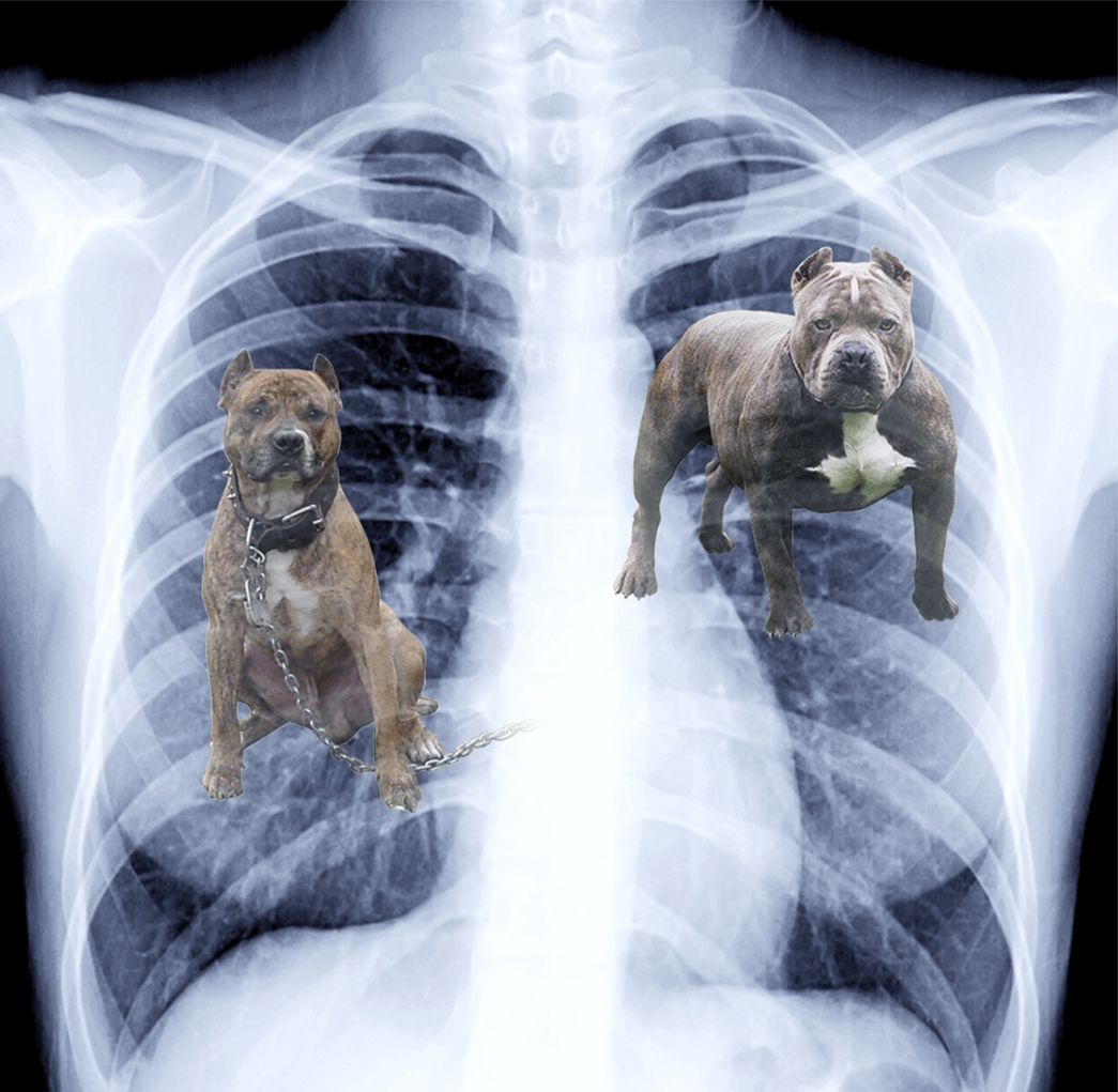 Justin Herbert X-rays