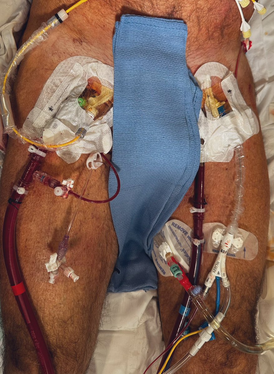 Atul D. Bali, MD tweet media