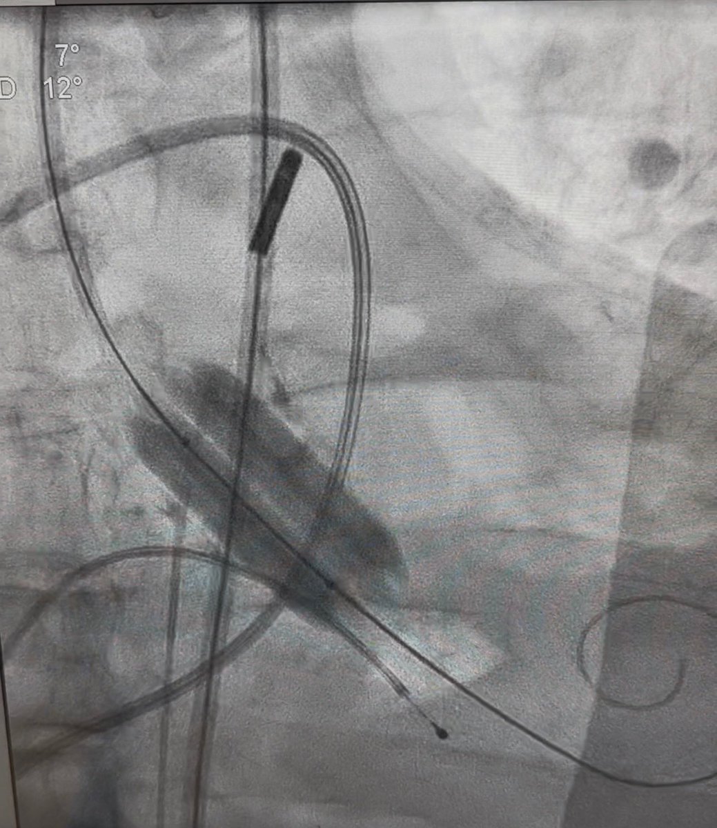 Atul D. Bali, MD tweet media