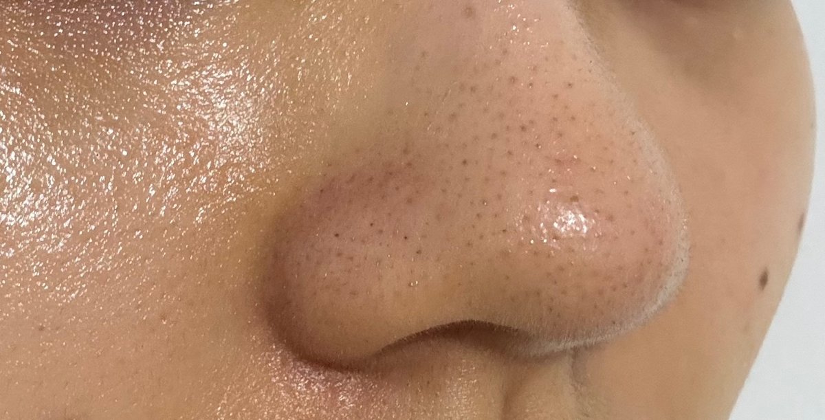 🚫 NO LINK! BACA RULES tweet media