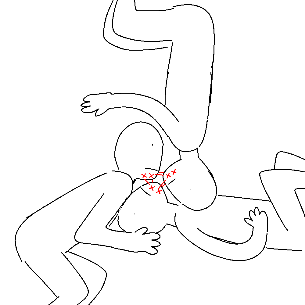 I had a dream where Meredith Grey, Karev, and Jo were captured by a villain obsessed with lilac and pink, and when they woke up, their jaws were sewn together like so :