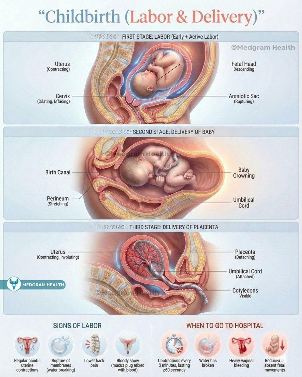 🤰 Childbirth (Labor \u0026 Delivery) is a beautifully coordinated process that  unfolds in three stages — from cervical dilation, to the birth of the baby,  and finally delivery of the placenta. Each, image size:960x1200