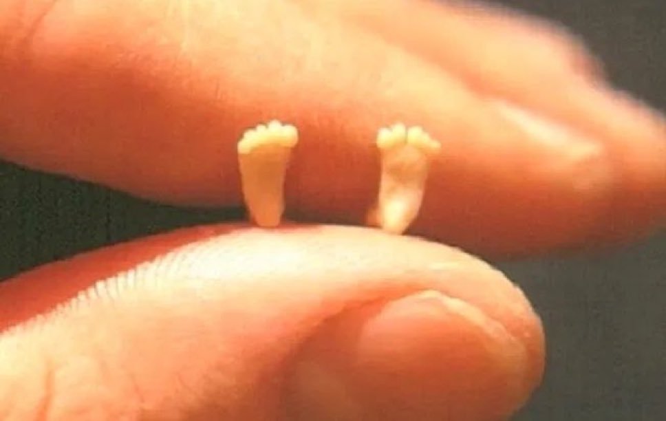 Este es el tamaño de los pies de un niño a las 10 semanas de gestación.

Está perfectamente formado, sólo necesita tiempo para crecer.

Los no nacidos no pueden hablar por sí mismo. Tú puedes hablar por ellos.