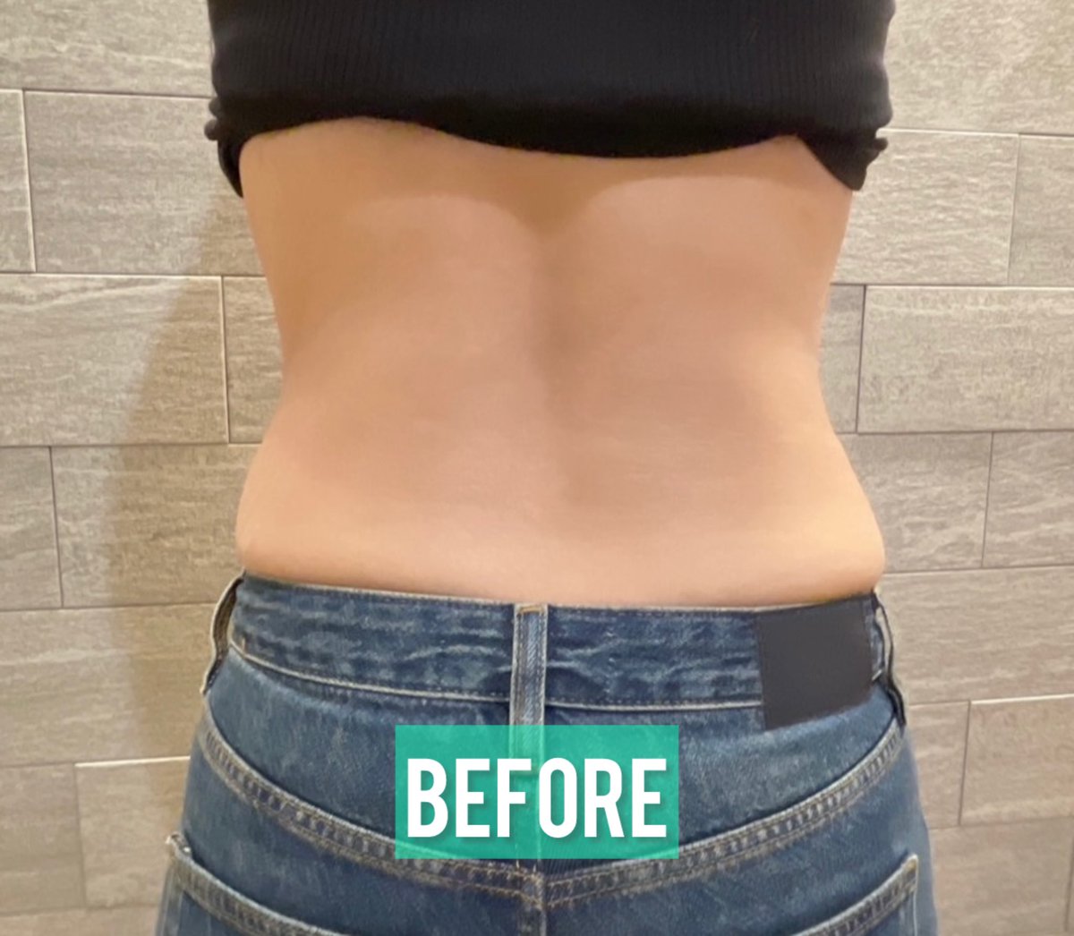 公式】プランエスクリニック（PLAN;SCLINIC） (@plansjp) / Posts / X