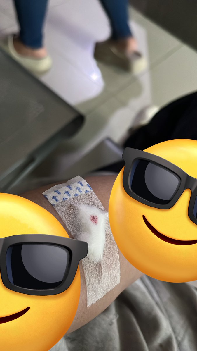 Tadi pagi balik untuk check lab, dan alhamdulillah trombosit naik 3 dr 167 ke 170 🌝. Dokter say “Semua aman ya, tapi harus evaluasi trombosit lg, klo masih demam dlm 3 hari nanti check lab lg”
Bahagia karna bsk gk perlu check lab, tangan gw dah biruu2 🌝😭