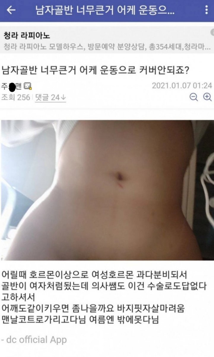 골반뼈 트젠 어쩌고를 대충 보다가 이 남자는 어떻게 살고잇을까 이 남자가 죽어 고고학자에게 발견된다면 여자로 명명될것인가 남자로 명명될 것인가 생각햇다.