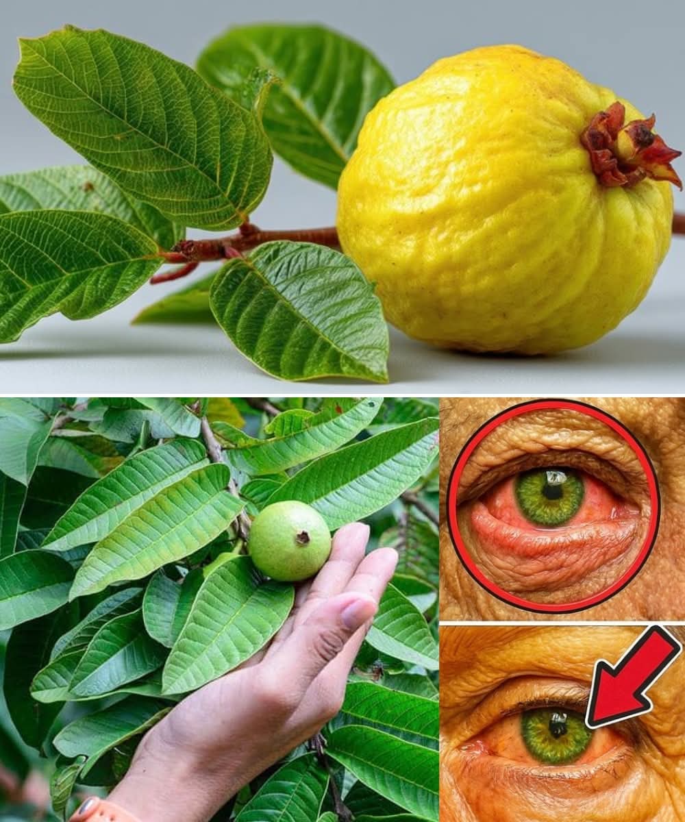 DrNaturalCare's tweet image. Guava for Clear Vision 👁️🍃
Why ignore what nature freely gives?
🌿 Guava leaves &amp;amp; fruits are rich in vitamin A, C, and antioxidants that protect the eyes from oxidative stress, dryness, and blurred vision.

✅ How to use:
1️⃣ Boil 5–7 fresh guava leaves in 2 cups of water