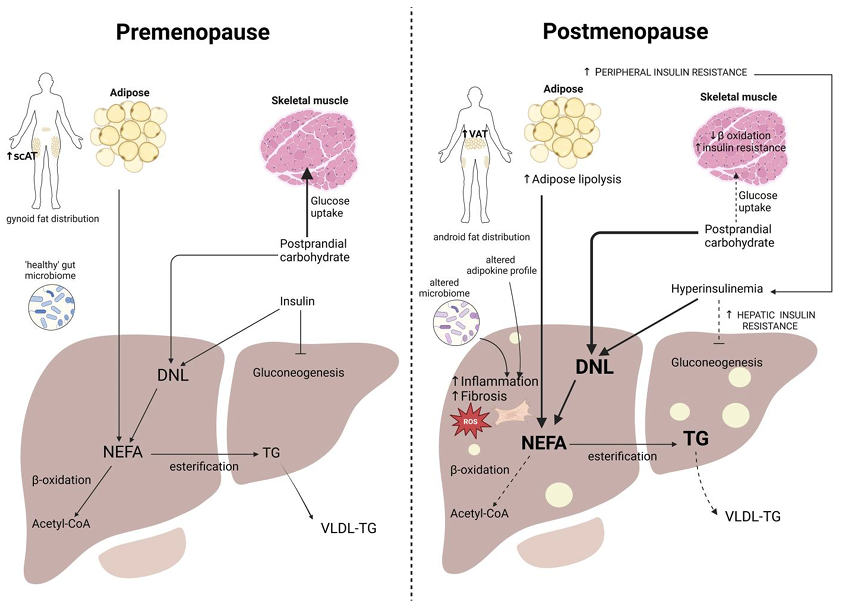Estrogen deficiency shifts fat from subcutaneous to visceral depots, drives hepatic and muscle insulin resistance, and promotes #MASLD via increased NEFAs, impaired β‑oxidation/VLDL export, upregulated DNL, inflammation, and fibrogenesis. #menopause
<a href="/EndoSocJournals/">Endocrine Society Journals</a>