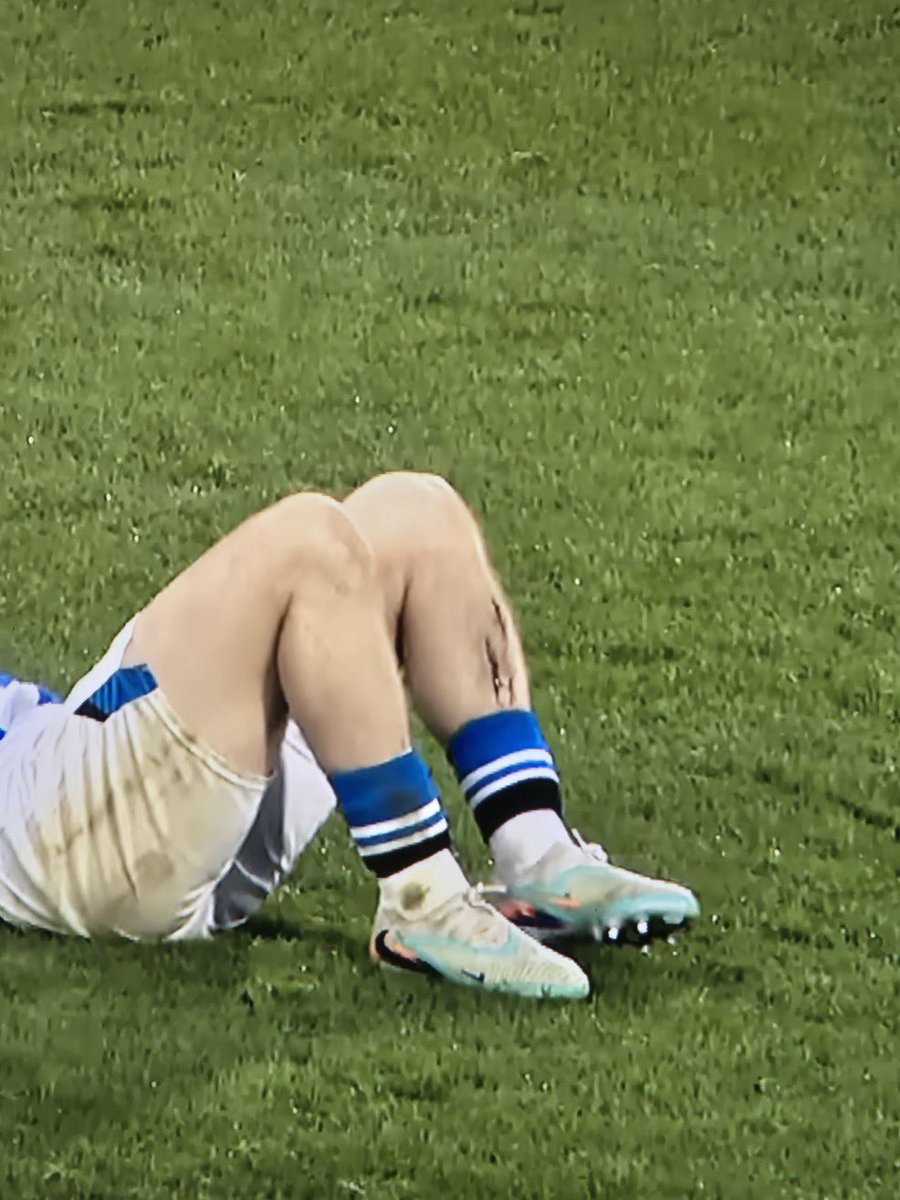 FTBLsection's tweet image. Every time a player gets injured, the first thing you hear is people moaning about the schedule being too tough. But no one ever talks about the fact that shin pads are getting smaller and smaller. Look at James Milner, longest Premier League career going, and he’s still wearing…