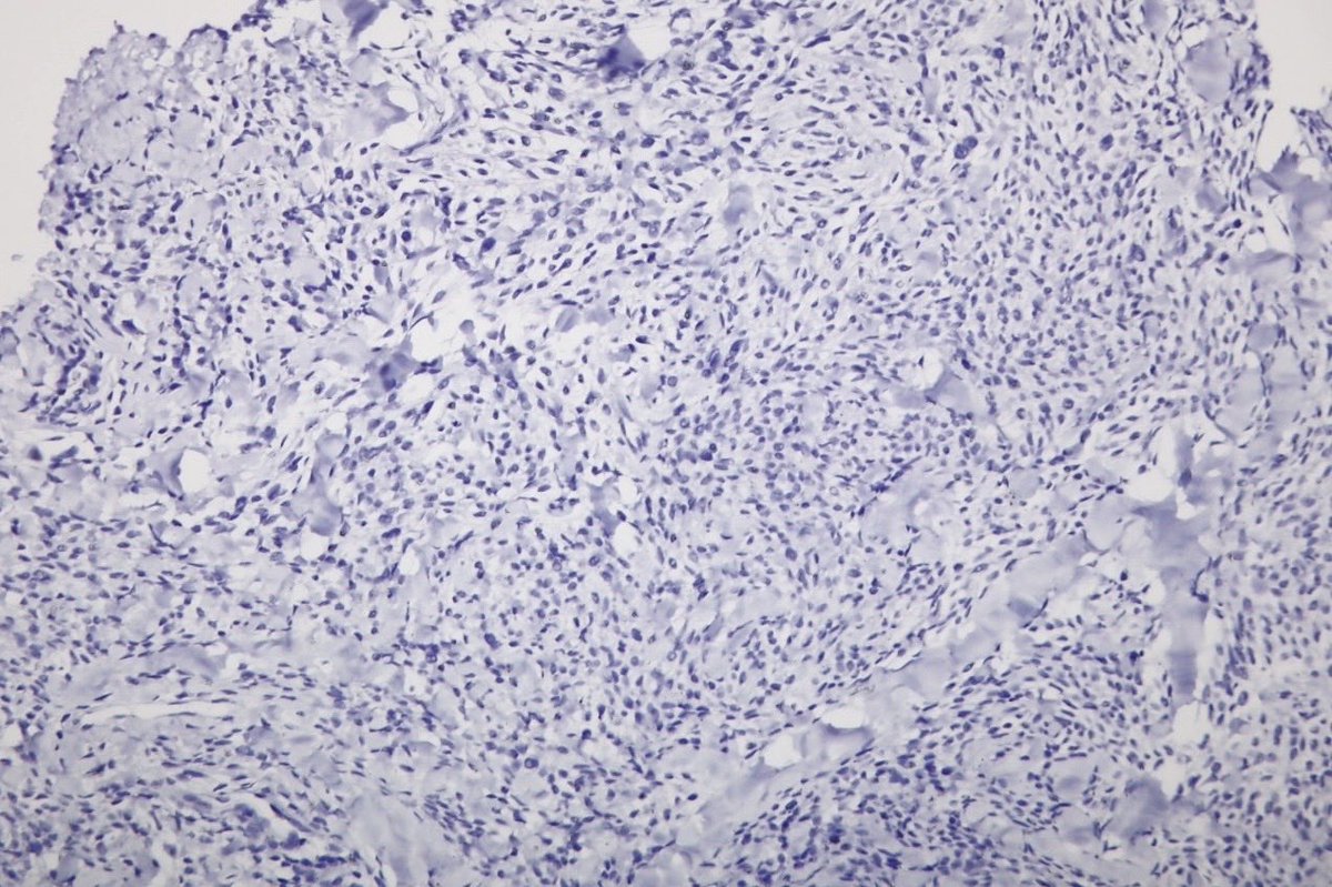 Surgical Pathology Cases tweet media