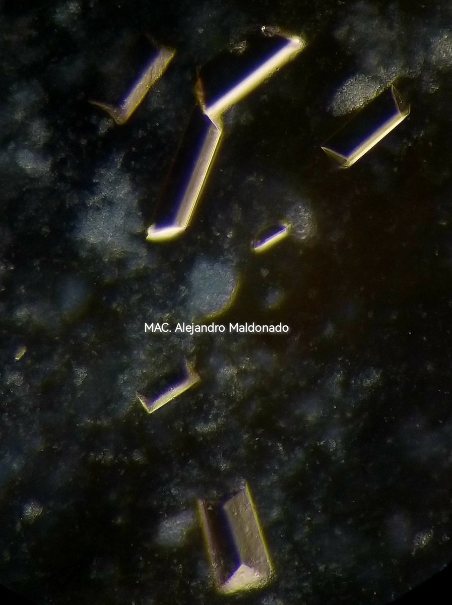 MACAlejandroMal's tweet photo. Cristales de Fosfato Amonico Magnesico 

Microscopia de luz polarizada y campo oscuro 

Hecho en Chiapas 😁🙌🏻

#UrineSediment #Urinalysis https://t.co/XLOxWrcbV4