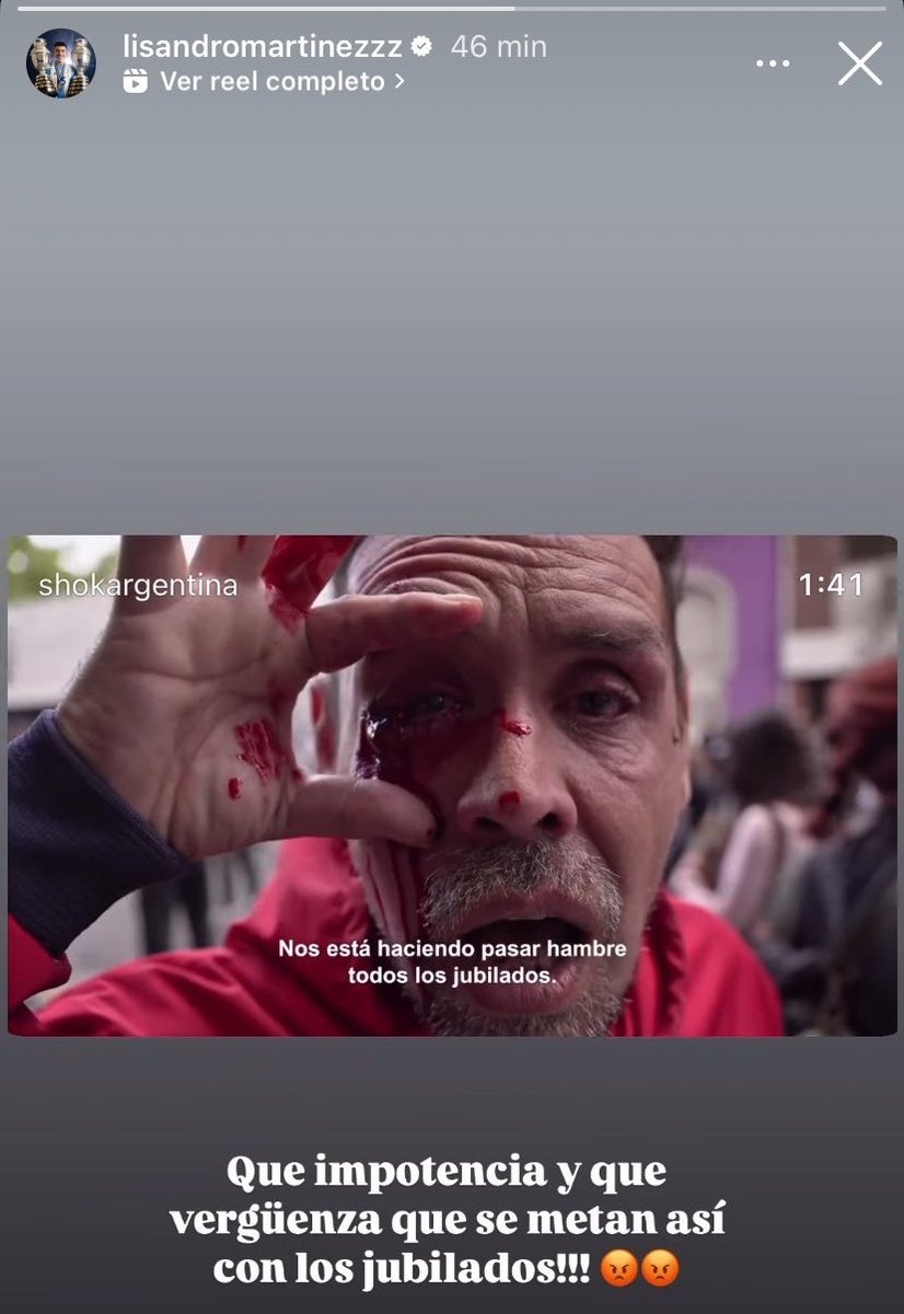 champagnemdmi's tweet image. el mejor de los nuestros