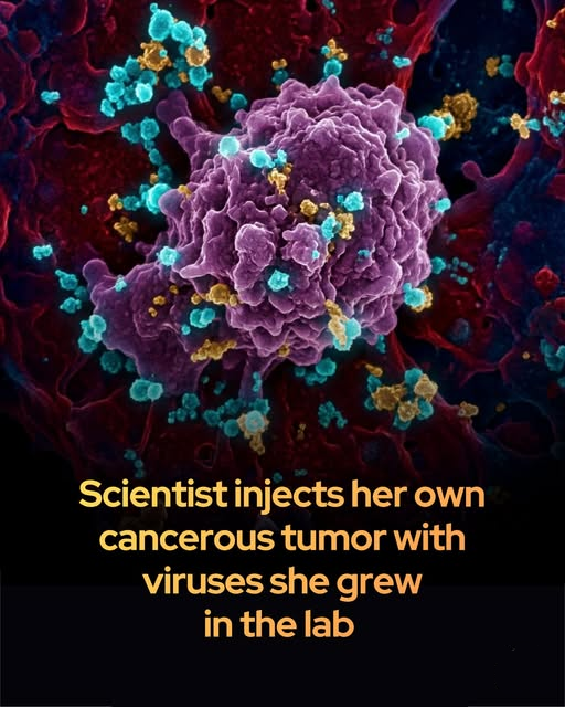 A virologist used a lab-grown mix of the measles virus to shrink her own cancer.

Dr. Beata Halassy, a virologist at the University of Zagreb, had overcome breast cancer twice before. In 2020, when it returned for a third time after her mastectomy, she chose an extraordinary