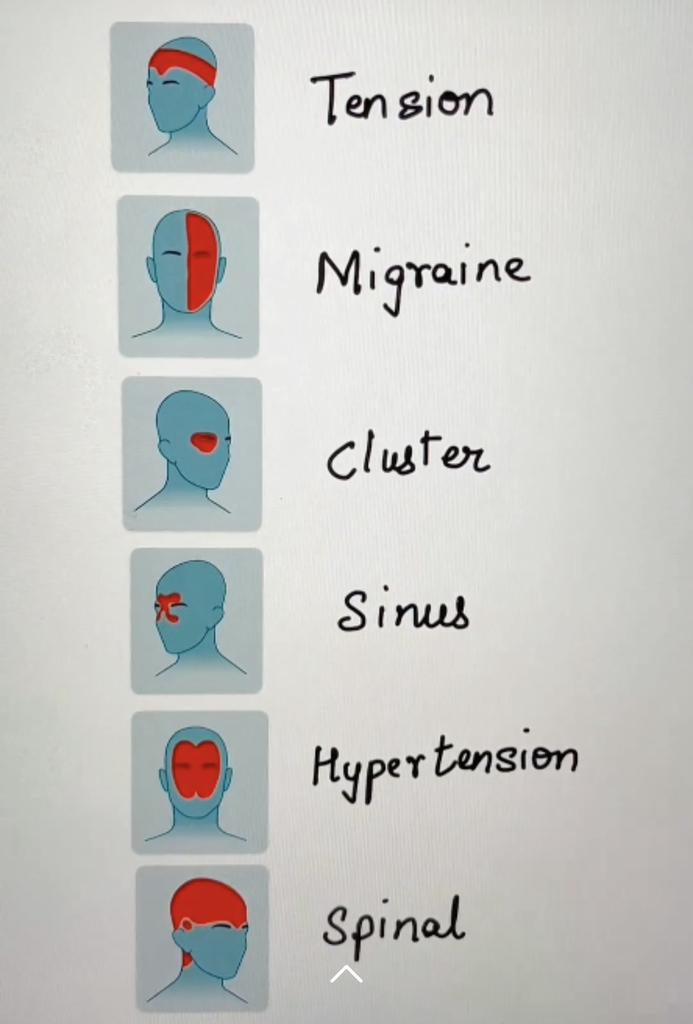 24x7knowIedge's tweet image. Types of headaches