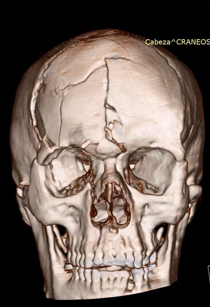 Solo con un casco correcto disminuye significativamente el riesgo en accidentes de motocicletas, Tu familia te espera en casa, CUÍDATE

Otro caso de la Guardia decembrina!